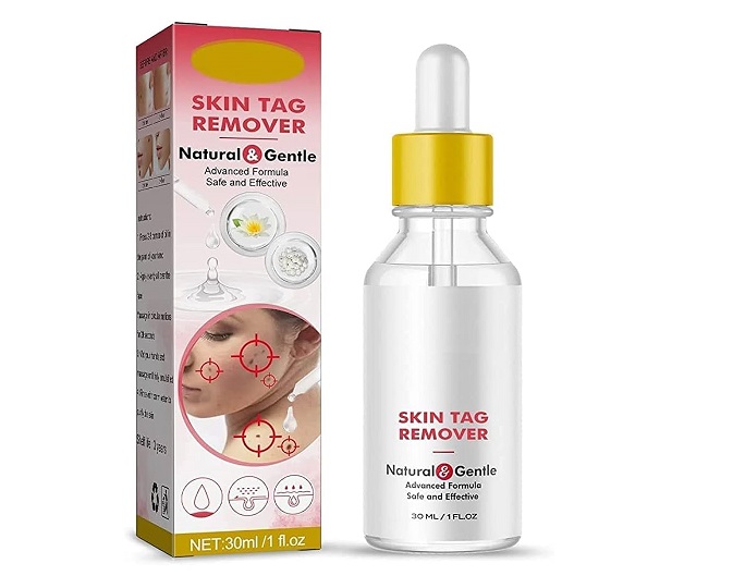 Paradise Skin Tag Remover