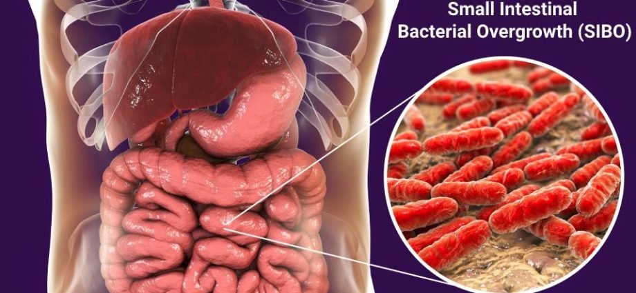 Small Intestinal Bacterial Overgrowth