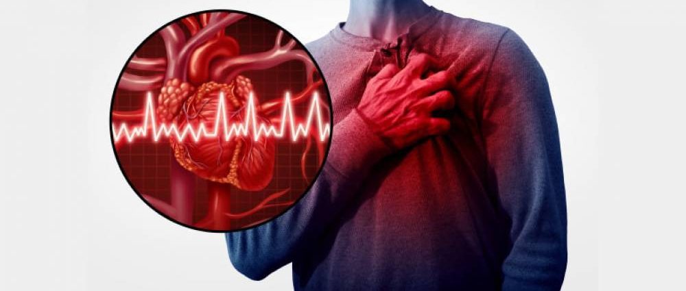 Understanding the Differences Between a Stroke and a Heart Attack
