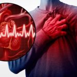 Understanding the Differences Between a Stroke and a Heart Attack
