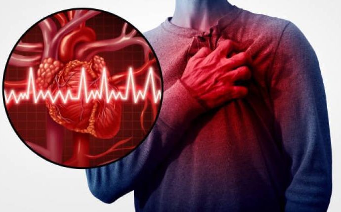 Understanding the Differences Between a Stroke and a Heart Attack