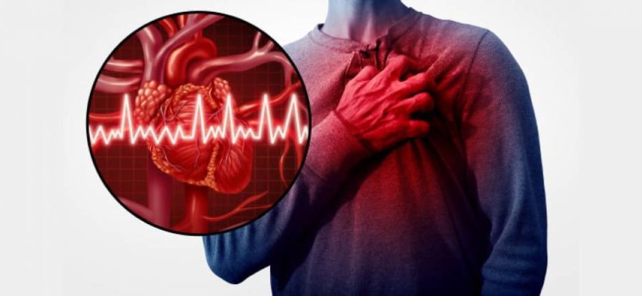 Understanding the Differences Between a Stroke and a Heart Attack