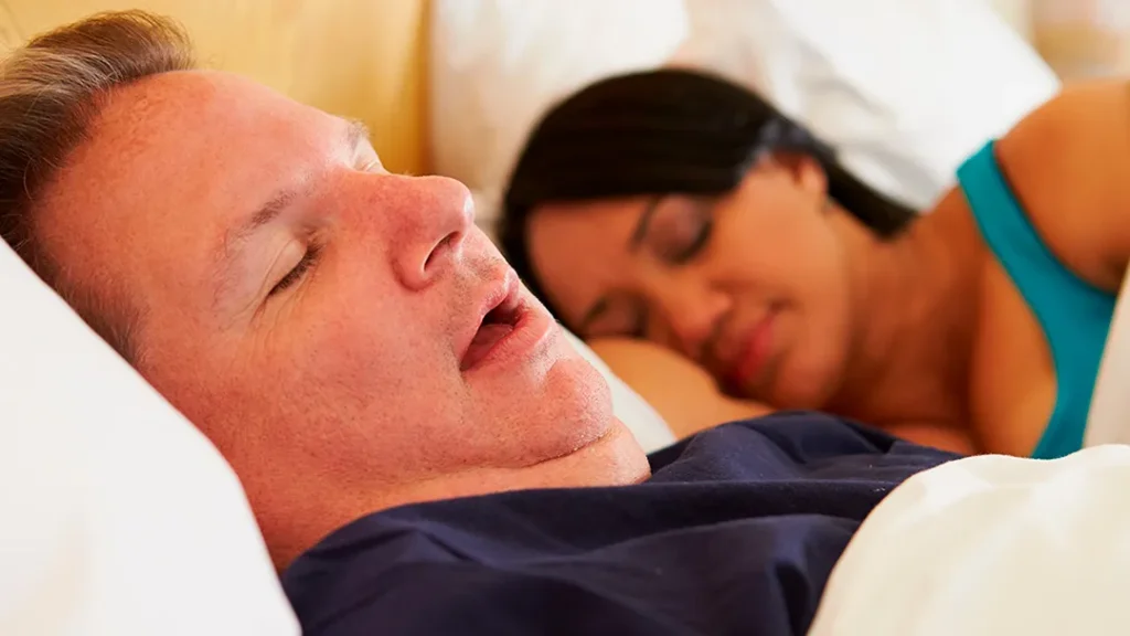 Obesity and Obstructive Sleep Apnea