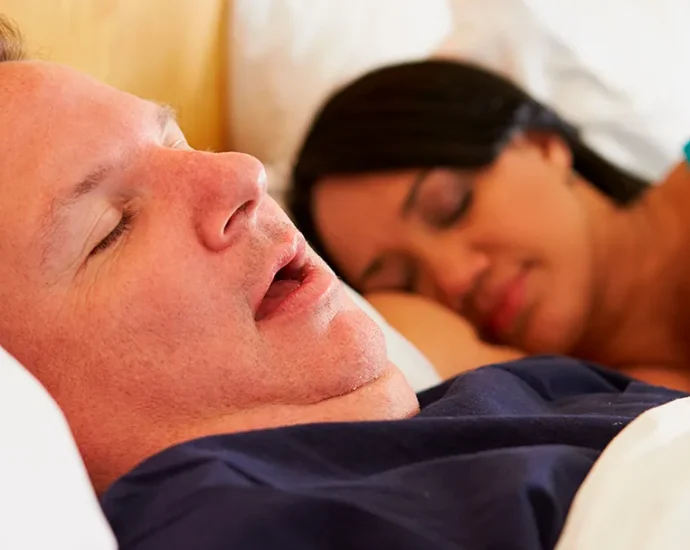 Obesity and Obstructive Sleep Apnea