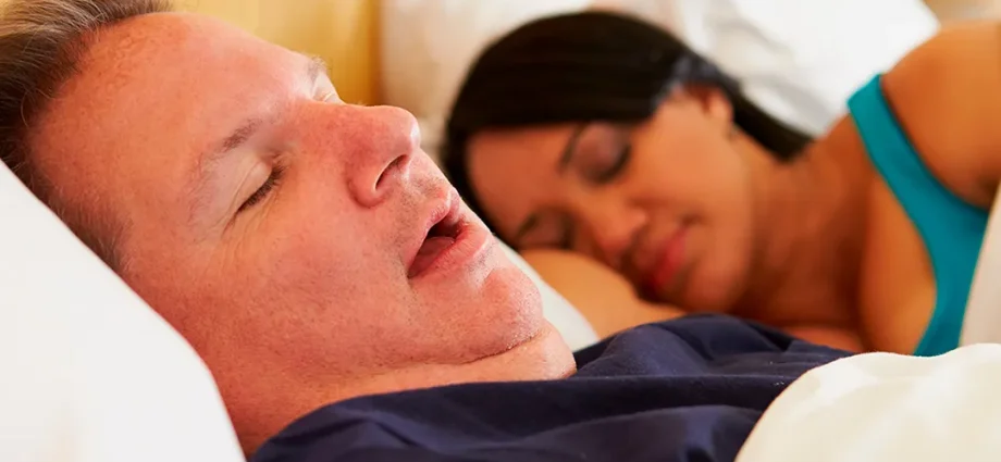 Obesity and Obstructive Sleep Apnea