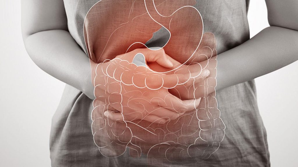 Crohn's Disease Treatment, Symptoms, Causes and Prevention