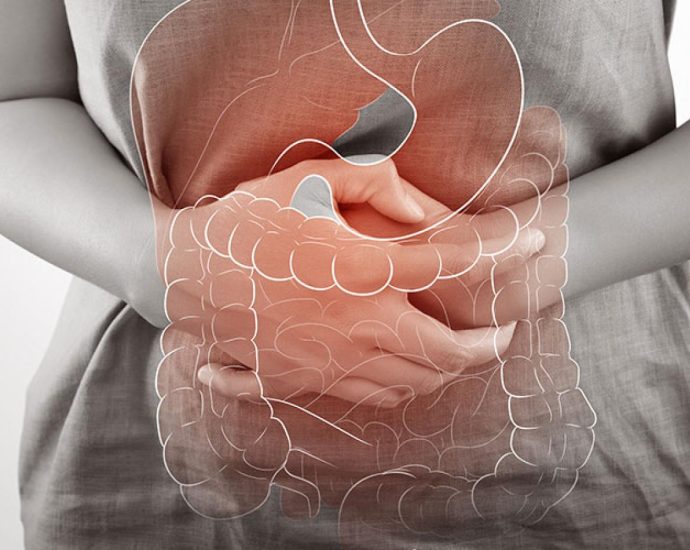 Crohn's Disease Treatment, Symptoms, Causes and Prevention