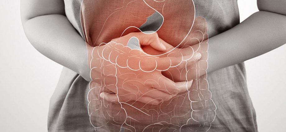 Crohn's Disease Treatment, Symptoms, Causes and Prevention