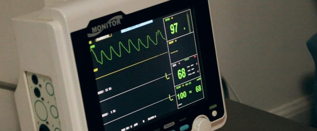 ElectroCardiogram