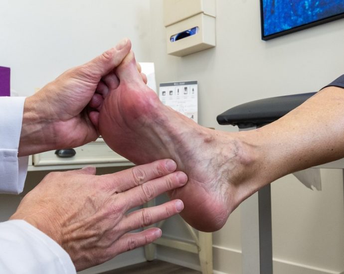 Plantar Fasciitis