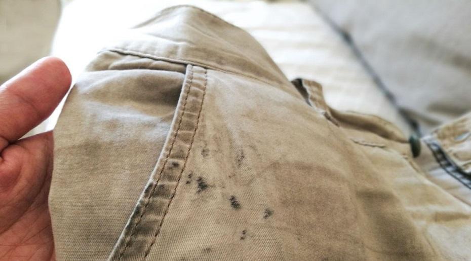 Remove Oil Stains From Pants