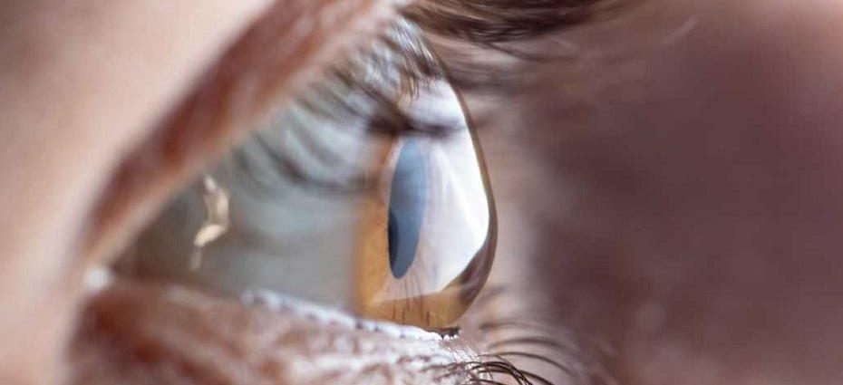 Astigmatism What Is It, Causes, Symptoms and Treatment