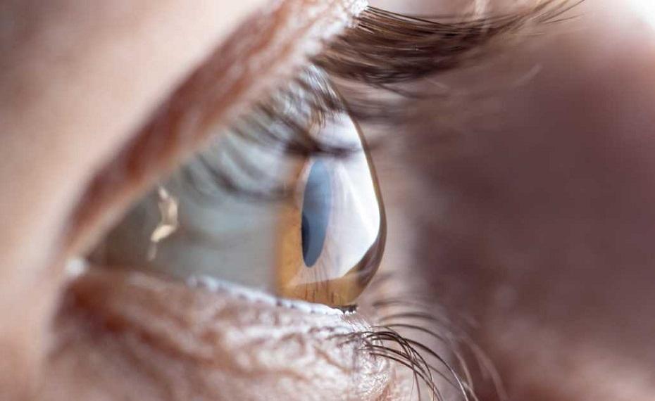 Astigmatism What Is It, Causes, Symptoms and Treatment