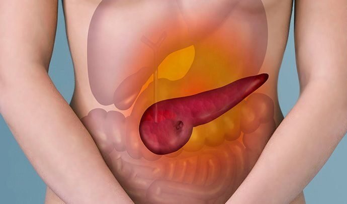 Pancreatitis What It Is, Symptoms and Treatment