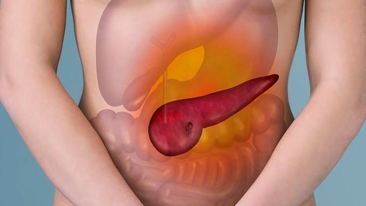 Pancreatitis What It Is, Symptoms and Treatment