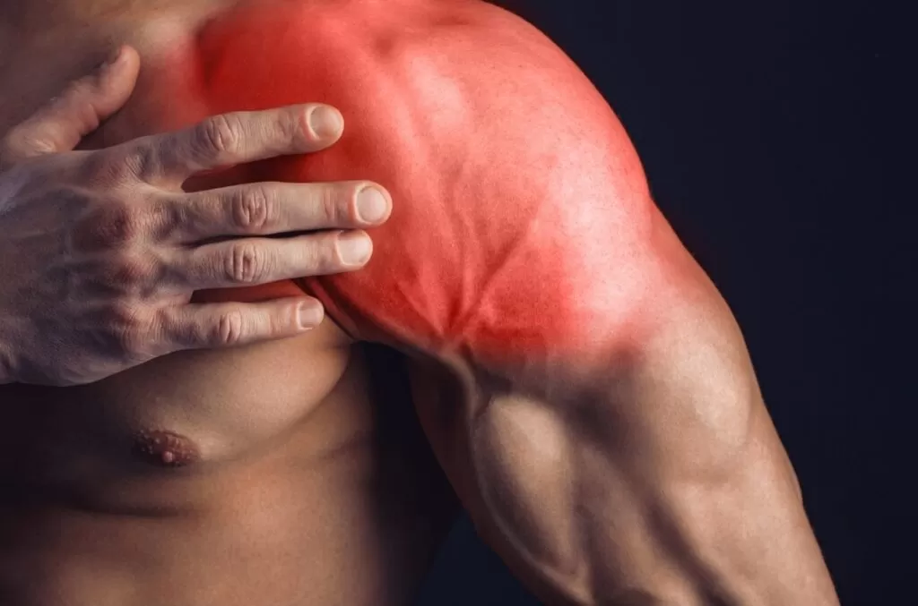 muscle tear