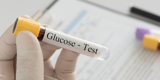 Oral Glucose Tolerance Test