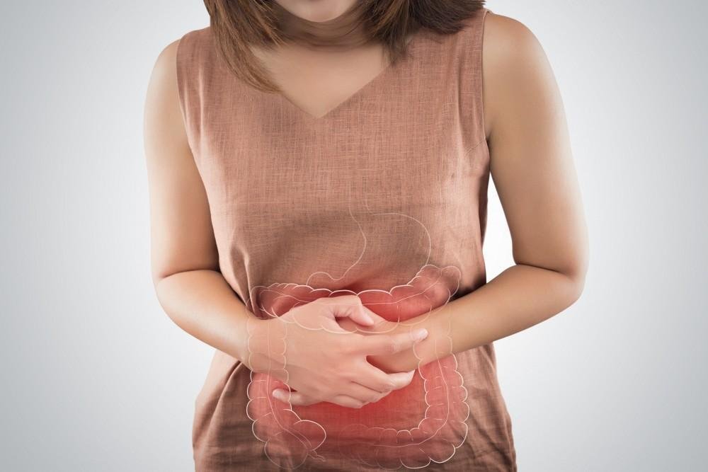 Irritable bowel syndrome FODMAP Diet