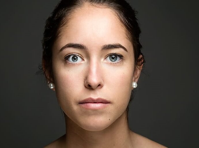 Myasthenia gravis Symptoms and causes