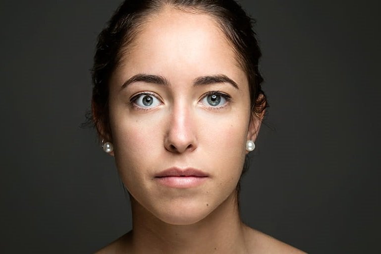 Myasthenia gravis Symptoms and causes