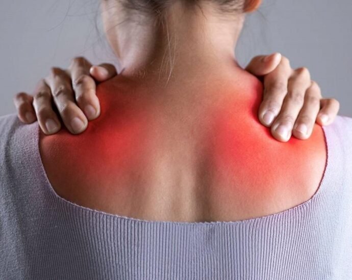 fibromyalgia
