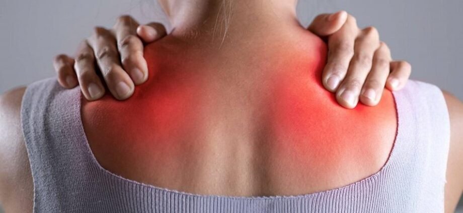 fibromyalgia