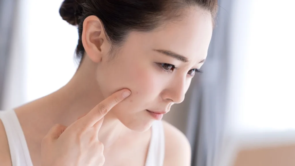 skin blemishes