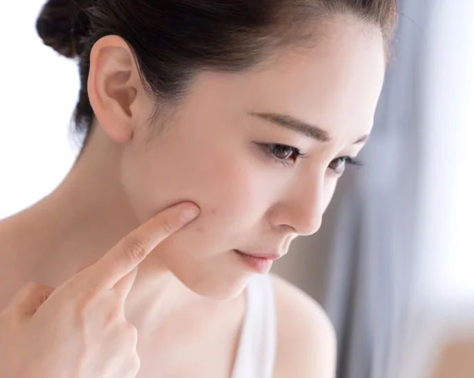 skin blemishes