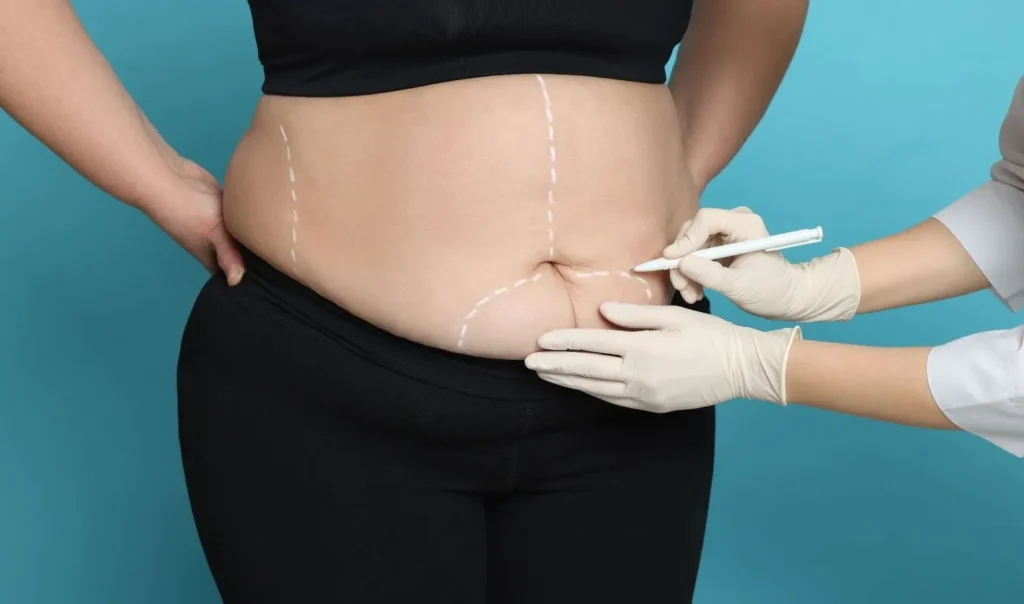 Bariatric Care