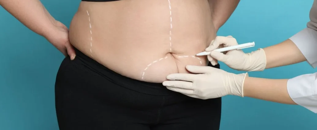 Bariatric Care