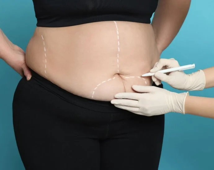 Bariatric Care