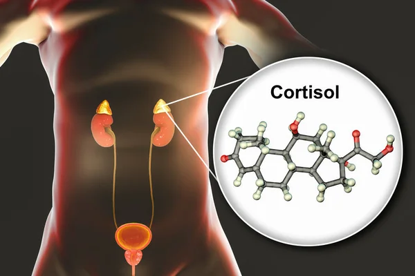 What Are the Symptoms and Causes of High Cortisol Levels