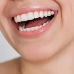 Tooth Trouble - How Ozempic May Be Affecting Your Dental Health
