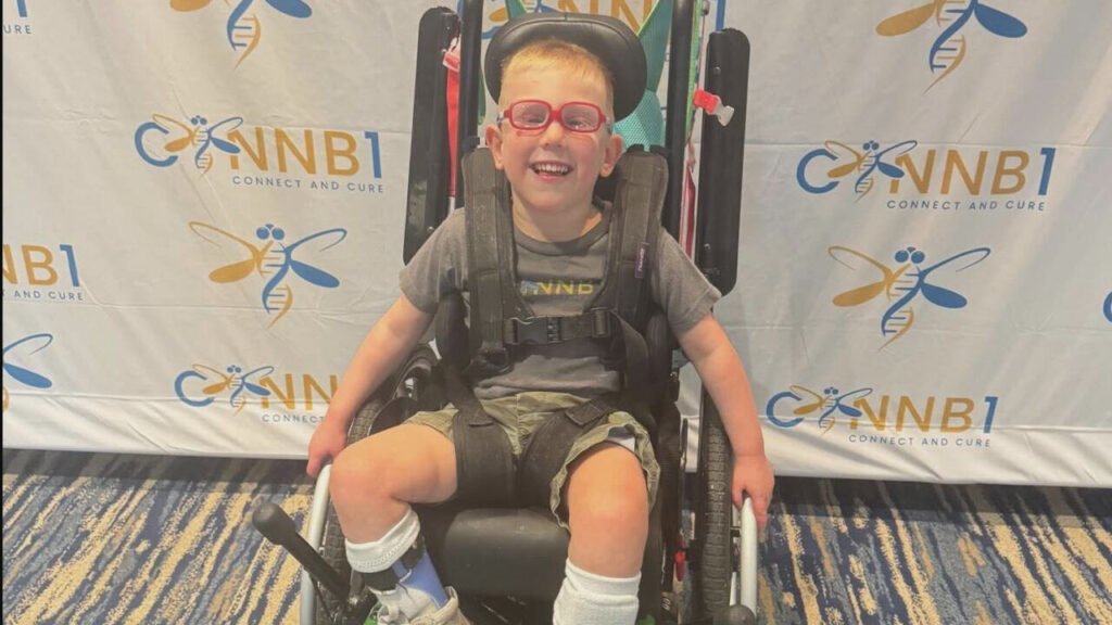CTNNB1 syndrome