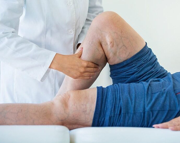 Is It Possible to Prevent Thrombus Through Sports