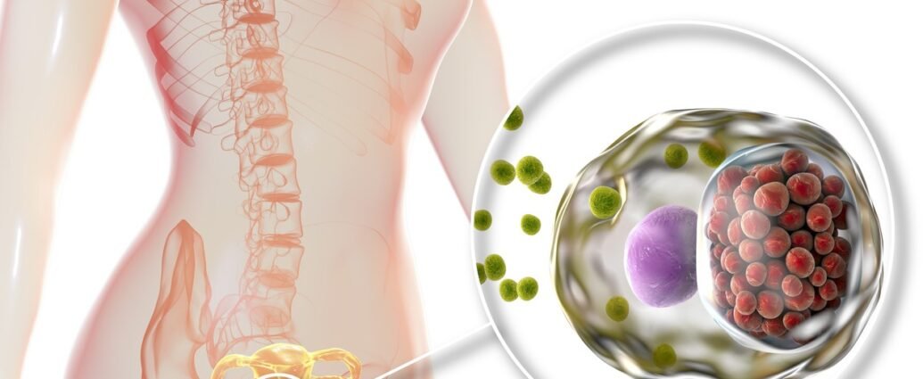 Sexually transmitted infections - how to differentiate them
