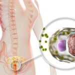 Sexually transmitted infections - how to differentiate them