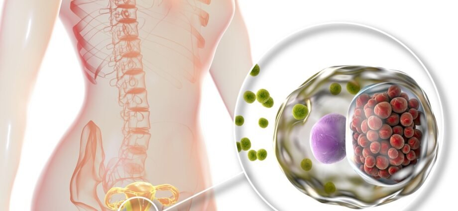 Sexually transmitted infections - how to differentiate them