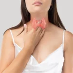 Hypothyroidism