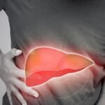 Rapid Weight Loss and Fatty Liver - A Complete Review