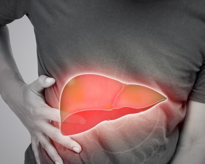 Rapid Weight Loss and Fatty Liver - A Complete Review